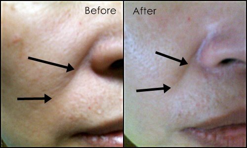 dr sebagh serum repair review before after