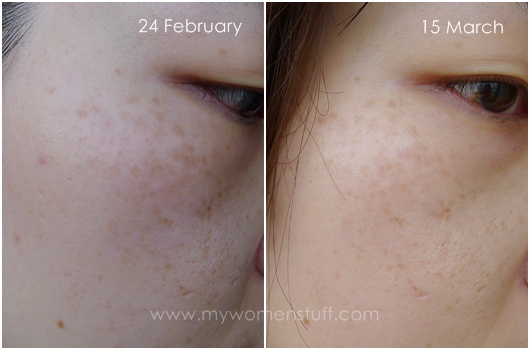 shiseido_white_lucent_serum