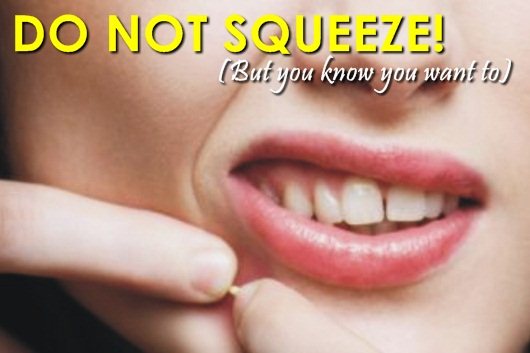 squeeze spots even when you aren't supposed to?